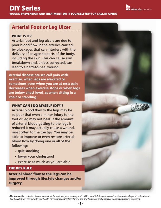 Arterial Foot or Leg Ulcers