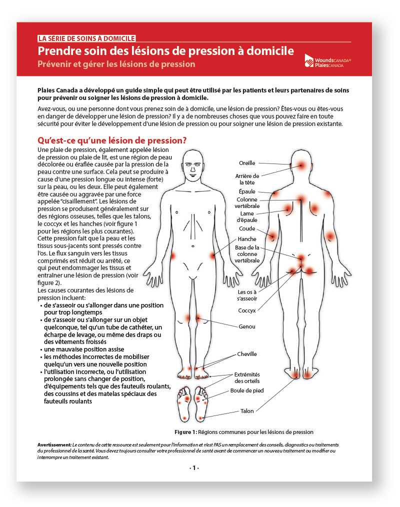 Prendre soin des lésions de pression à domicile: Prévenir et gérer les lésions de pression