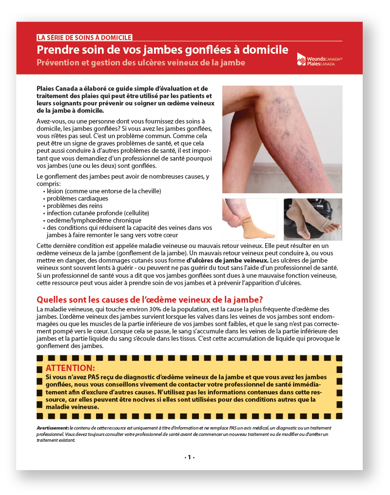 Prendre soin de vos jambes gonflées à domicile: Prévention et gestion des ulcères veineux de la jambe